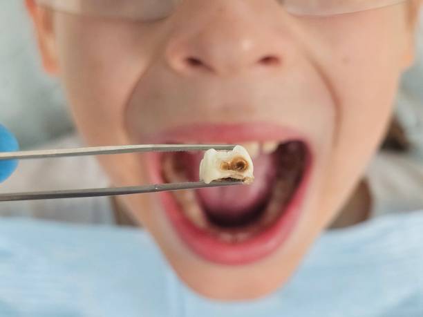 Best Knocked-Out Tooth Emergency  in Lyncourt, NY